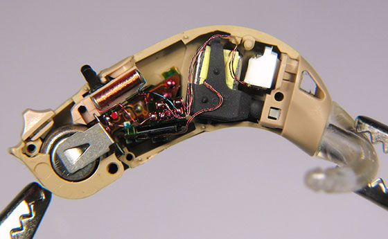 Hearing Aid Programming